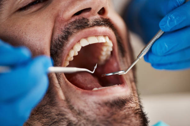 Best Cracked Tooth Emergency Dentist  in Hillsdale, NJ
